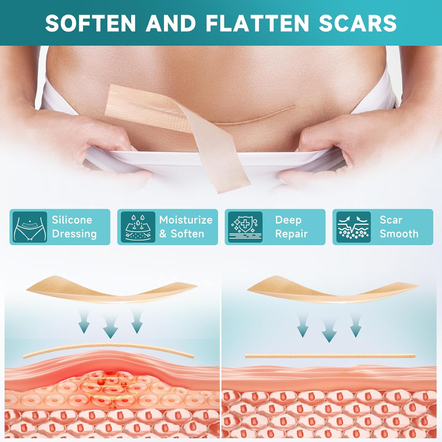 Detalle de Pumkot Silicone Scar Sheets: Medical-Grade Scar Tape for Surgical Scars, C-Sections, Burns