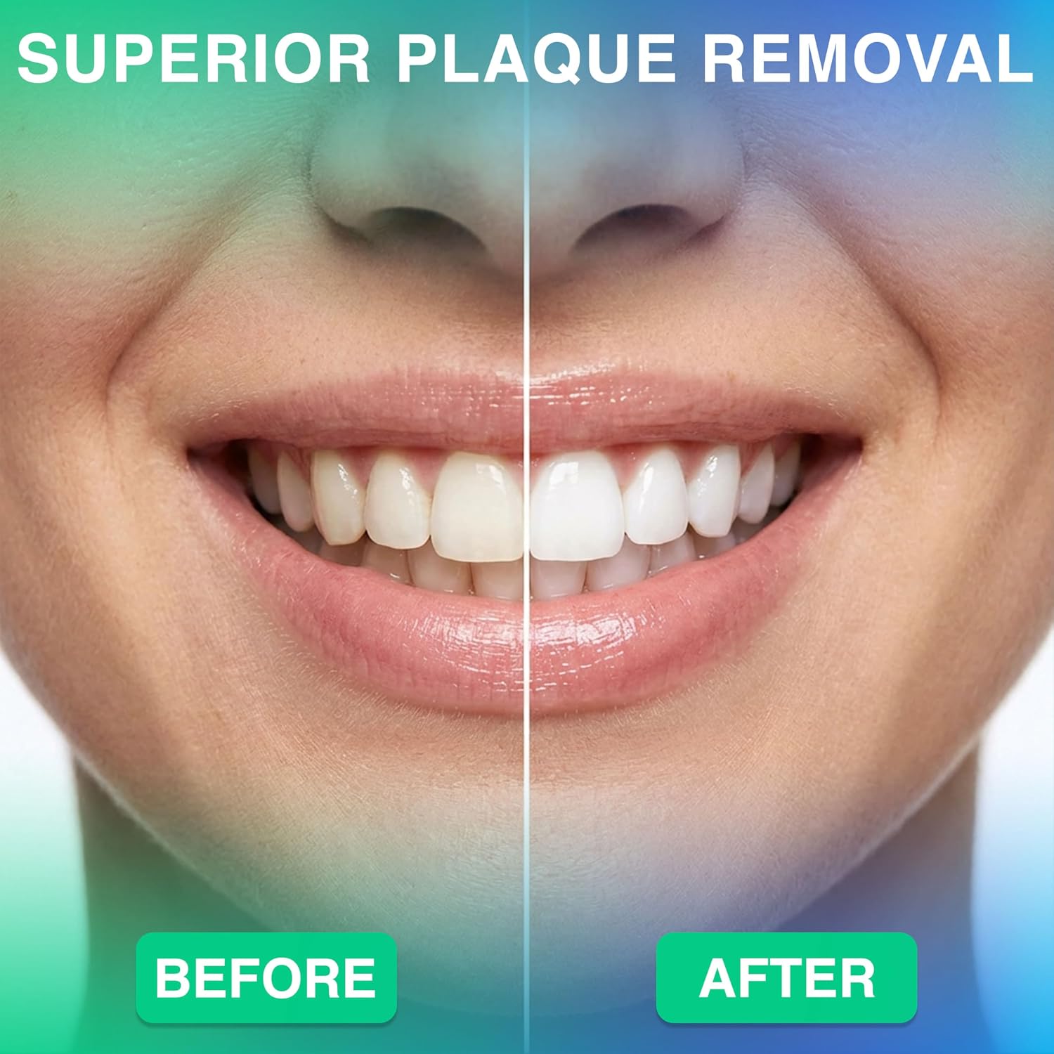Thumbnail 5 de Professional Water Flosser: Advanced Dental Care for a Healthier Mouth