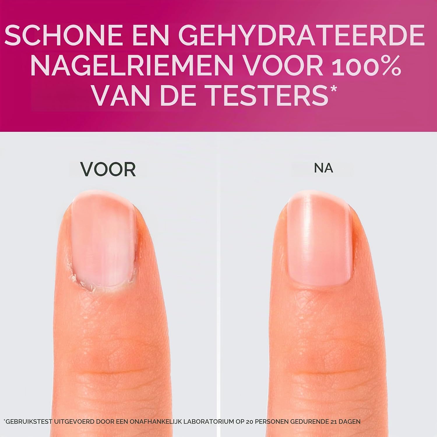 Thumbnail 2 de PODERM Cuticle Remover 2-in-1 nagelriemgel, exfolieert en hydrateert, 8 ml
