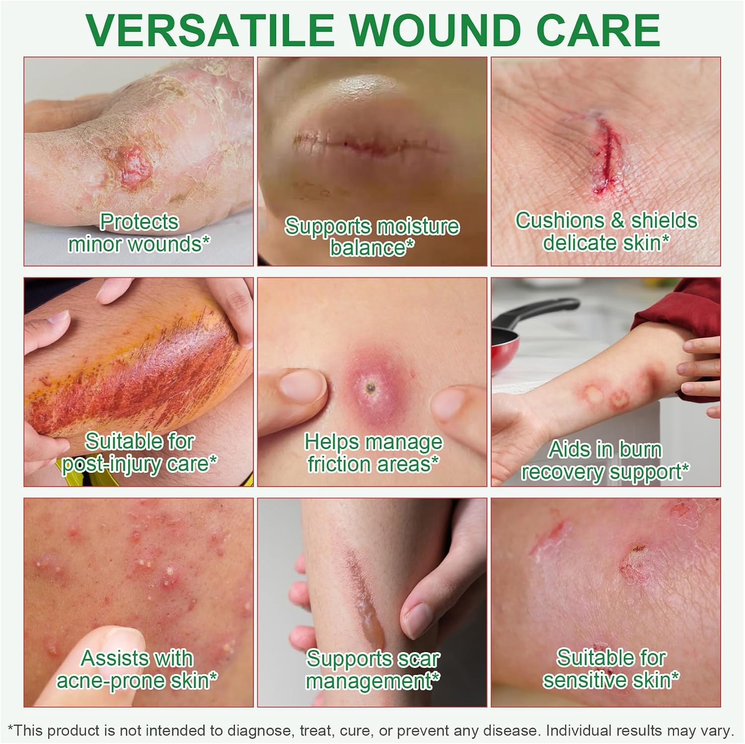 Detalle 2 de Hydrokolloid Pflaster Rolle 5cm x 150cm