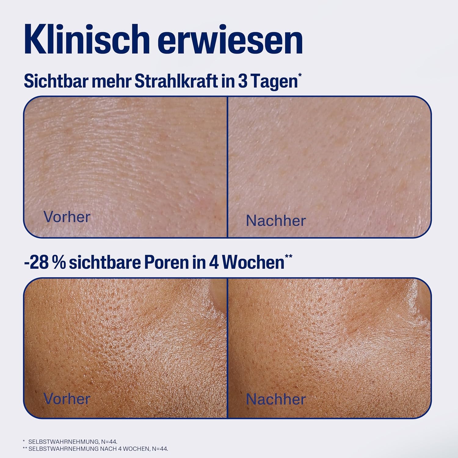 Detalle de Cetaphil Repair Nachtserum – Antioxidatives Nachtserum zur Unterstützung gestresster Haut