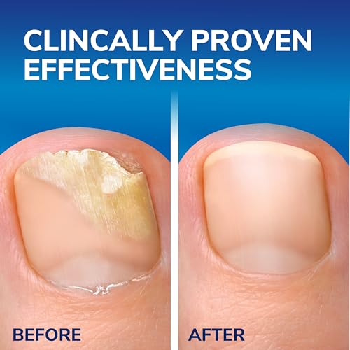 Thumbnail 8 de Scholl Fungal Nail Treatment 3.8ml (packaging varies) by Dr. Scholl's