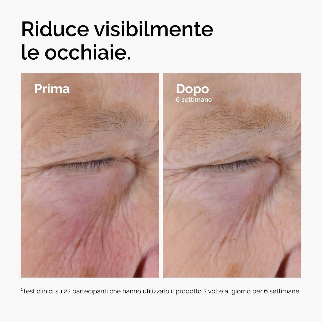 Detalle 2 de The Ordinary Caffeine Solution 5% + EGCG 30ml – Siero occhiaie e gonfiore, definizione del contorno occhi