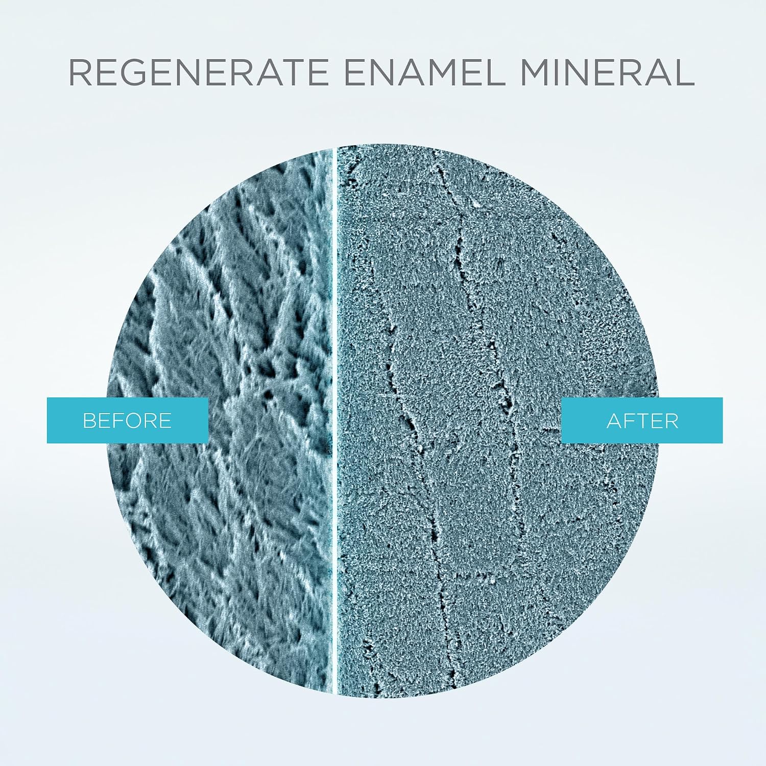 Detalle de Regenerate Dentifricio Avanzato NR-5 per Rigenerare lo Smalto Dentale, 75 ml