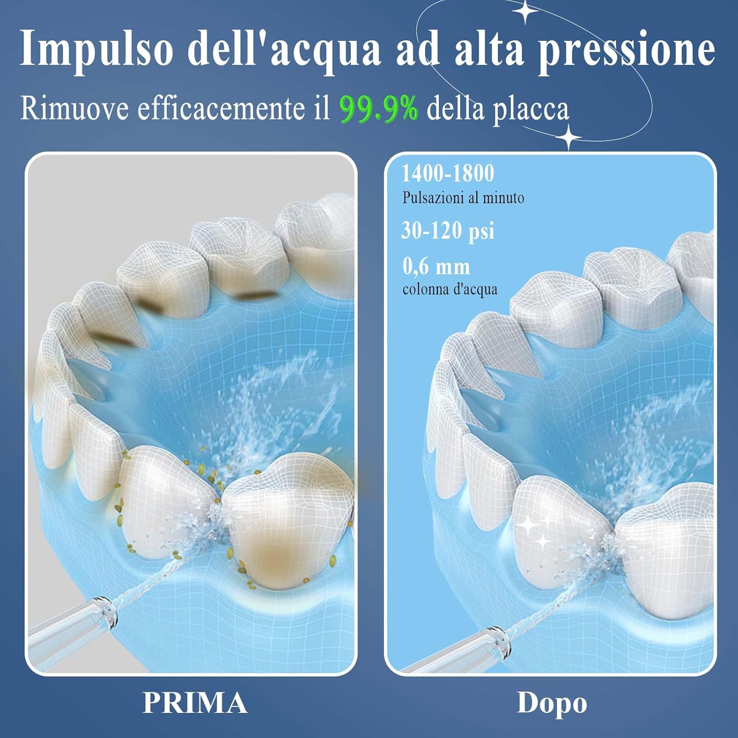 Detalle 2 de SURFOU Idropulsore dentale portatile, irrigatore orale da viaggio