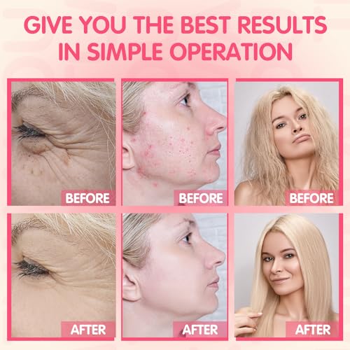 Thumbnail 3 de TUMAKOU Máquina Alta Frecuencia Facial ✨ con 4 varitas de Neón