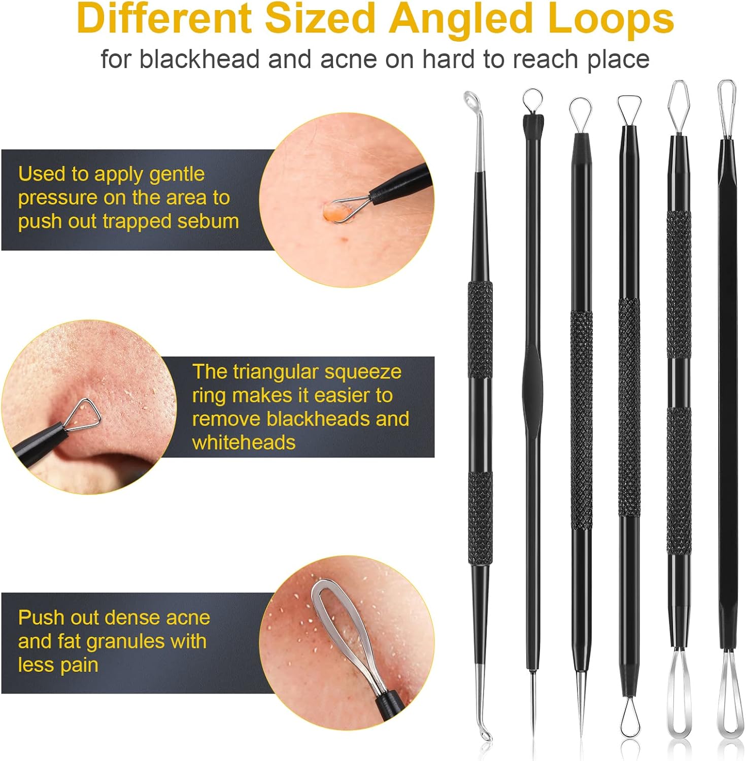 Detalle 2 de IUMAKEVP 15-piece blackhead extractor kit