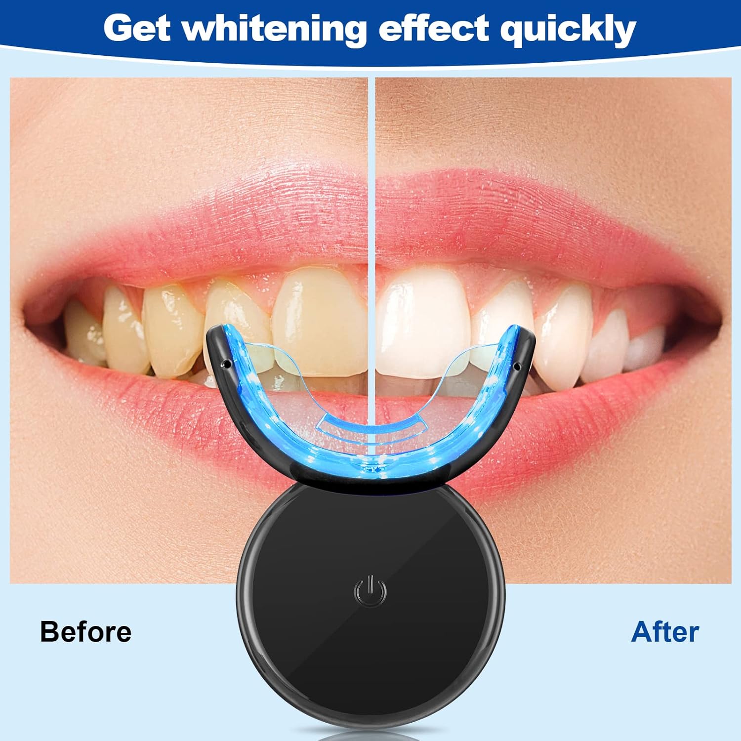 Detalle de Shynova Kit Sbiancante Denti Professionale 16 min 🦷
