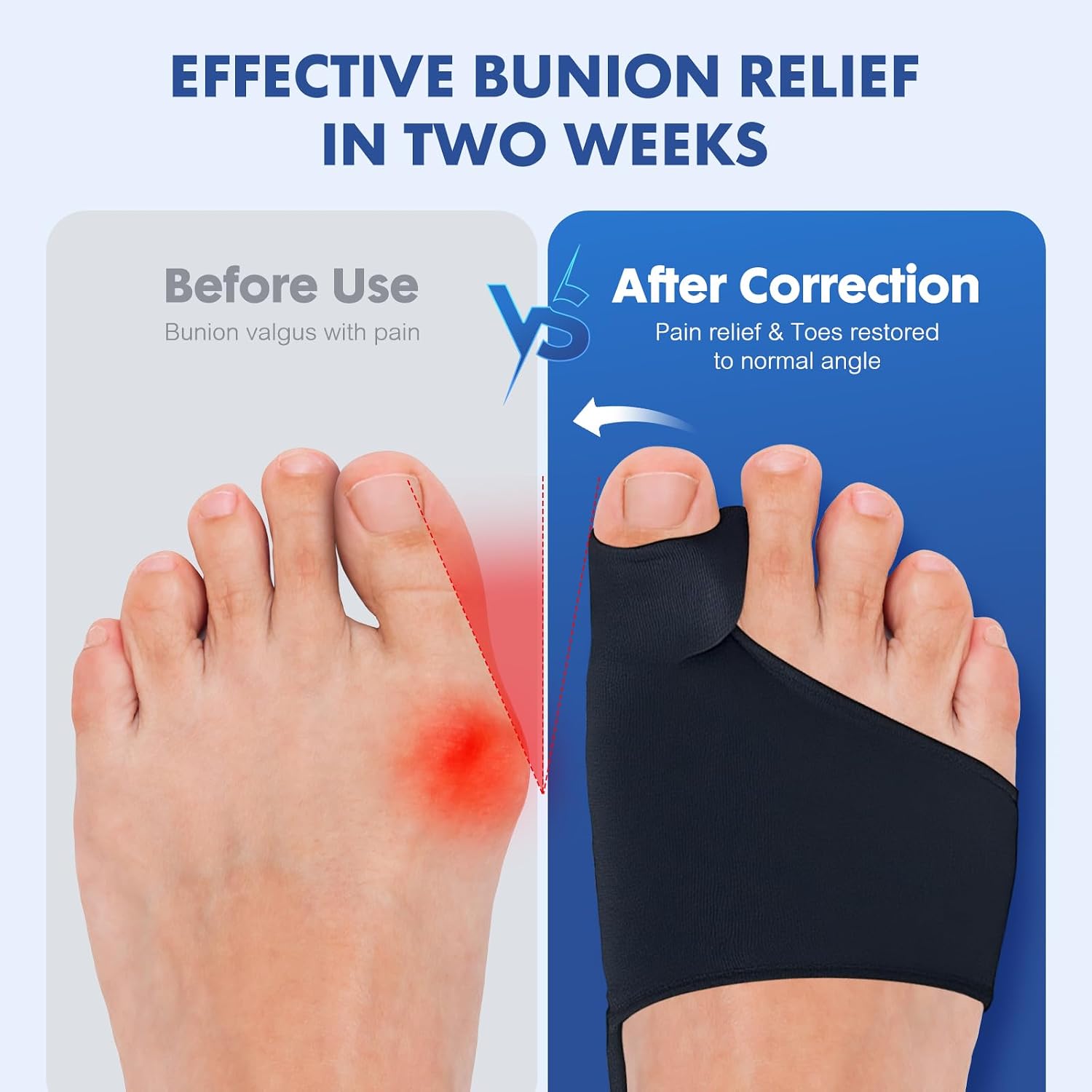 Detalle de QCCL Bunion Corrector 2-Piece Set