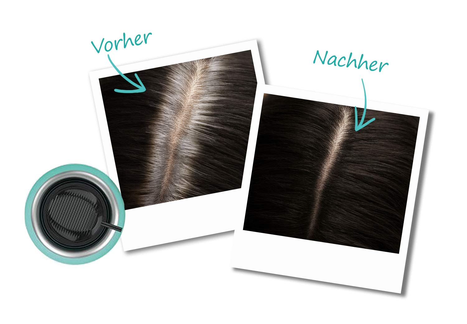 Thumbnail 4 de L’Oréal Paris Magic Retouch Ansatz-Kaschierspray Dunkelbraun bis Schwarzbraun (4er-Pack, 1×75 ml pro Dose)