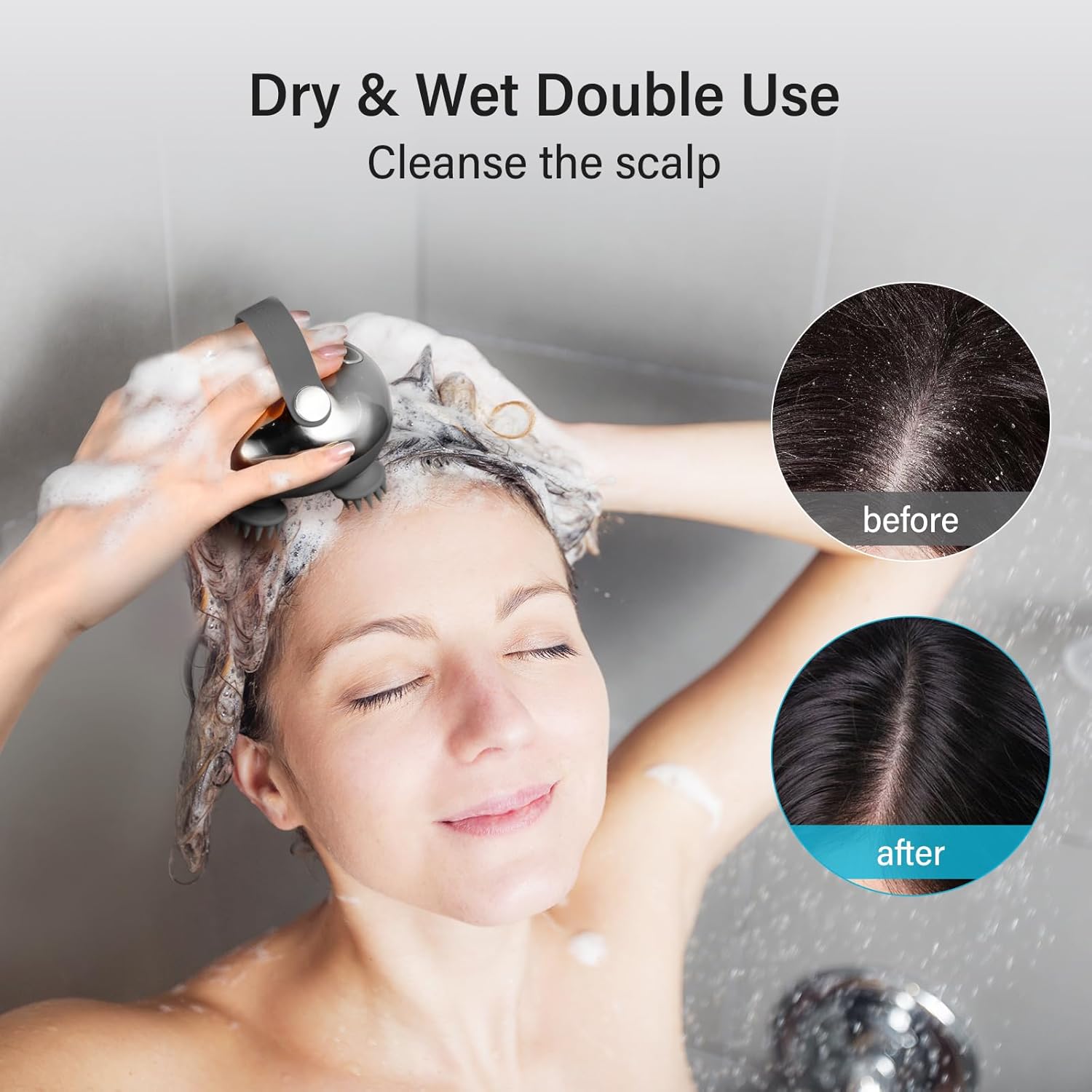 Detalle de arboleaf Scalp Massager Rechargeable Head Massager with 8 Removable Silicone Claws