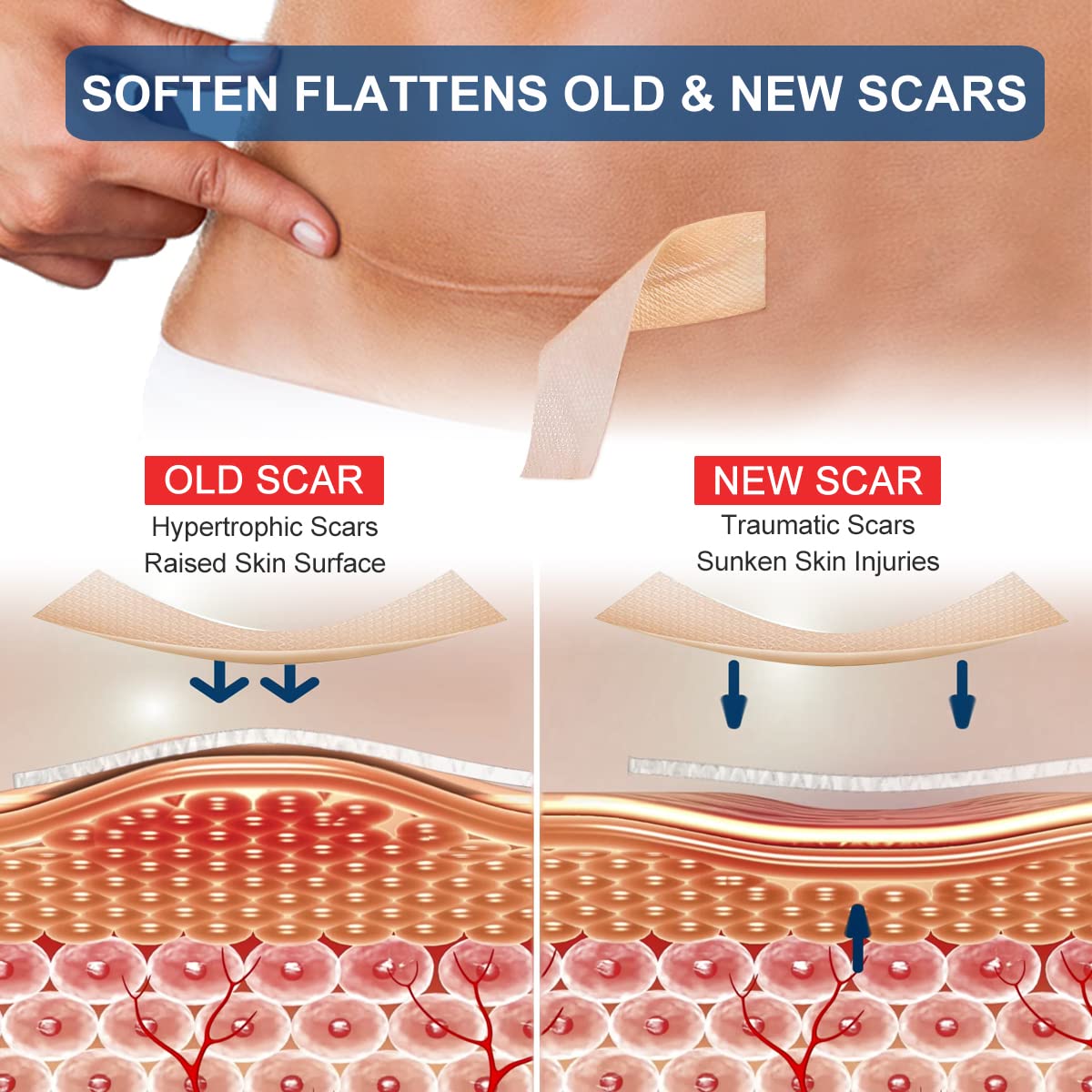 Detalle de Silicone Scar Sheets 1.6" x 120" Roll