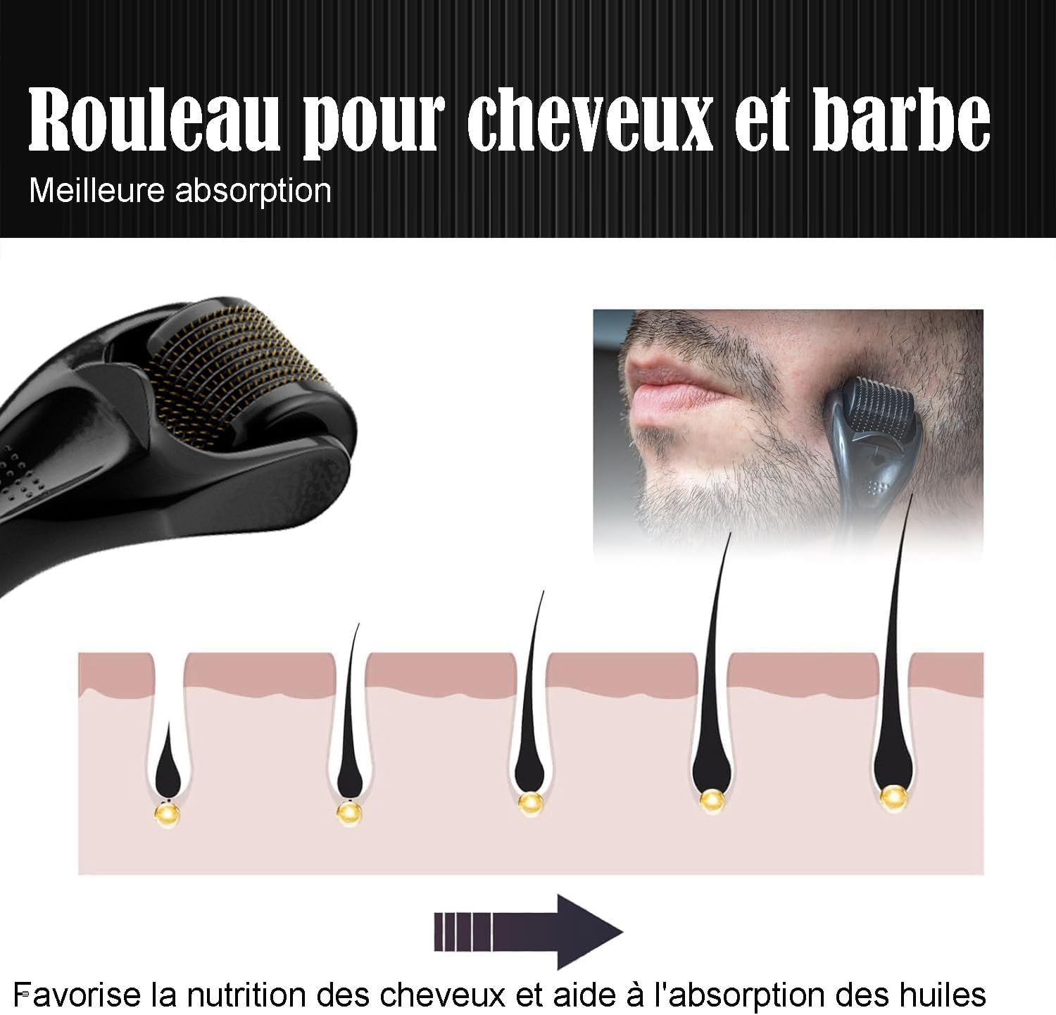 Thumbnail 4 de OCHILIMA Rouleau à barbe 1,0 mm 540 Titan