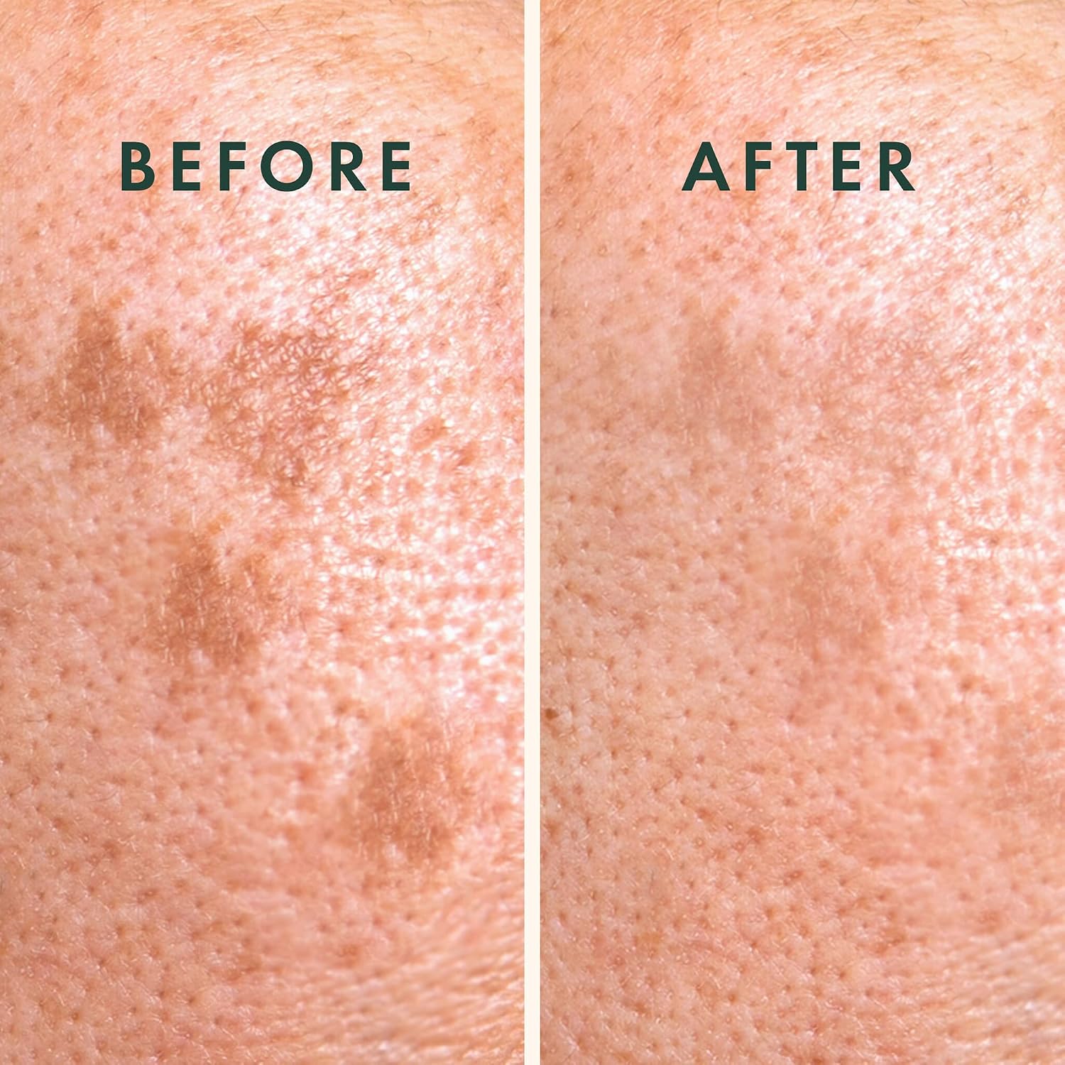 Detalle 1 de Rael Dark spot Microcrystal Vita C-pleisters voor donkere vlekjes, 9 stuks