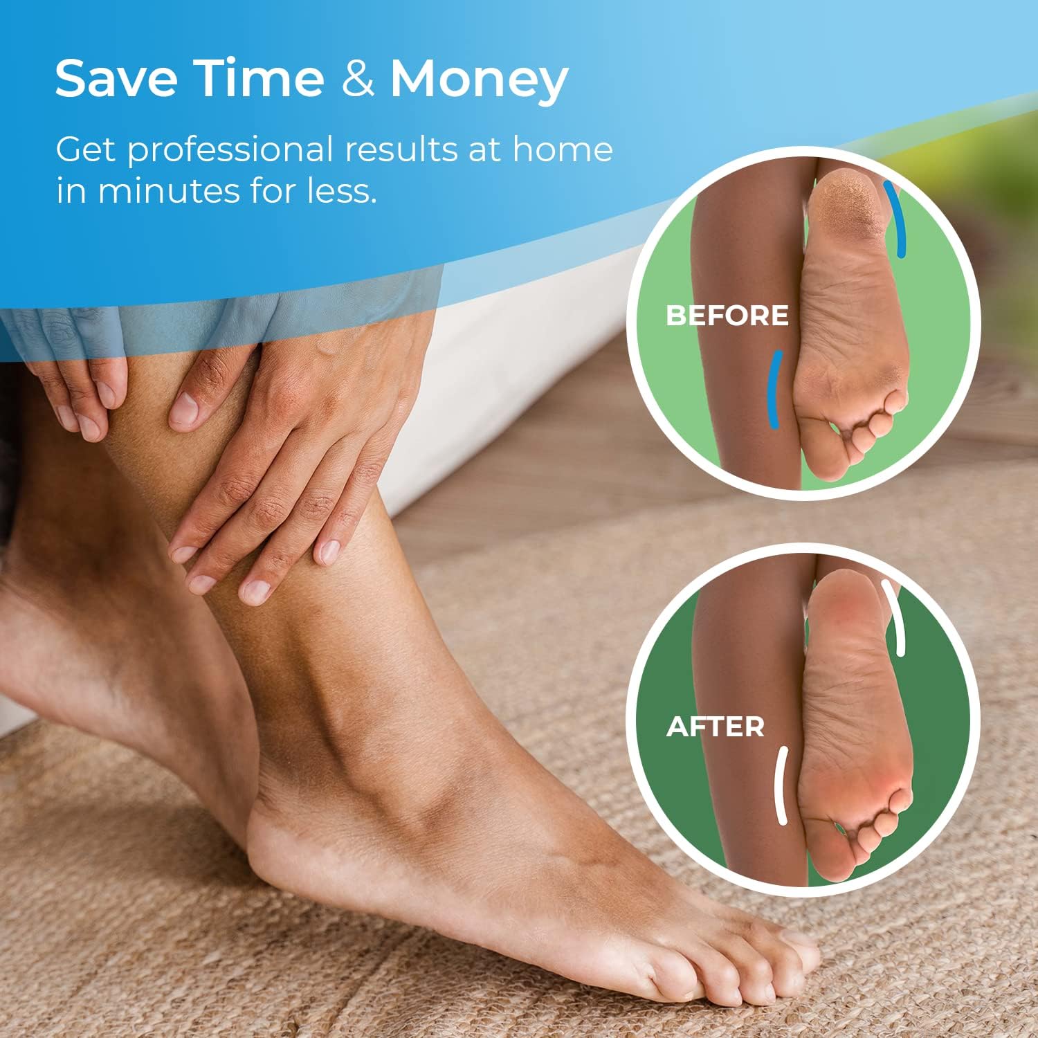 Detalle de 4 Pack Extra Coarse Roller Refills for Scholl Velvet Smooth Foot File