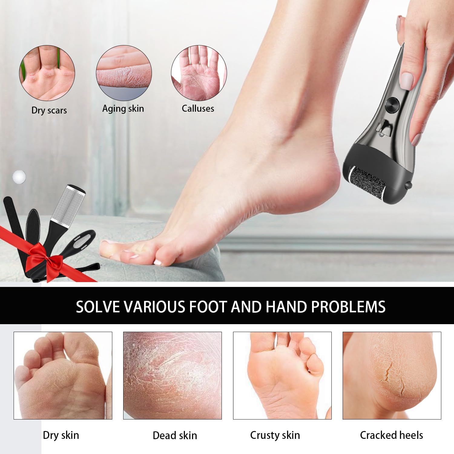 Thumbnail 2 de Jooayou Electric Foot File: USB Rechargeable Callus Remover with LED Spotlight and 3 Pumice Stone Rollers