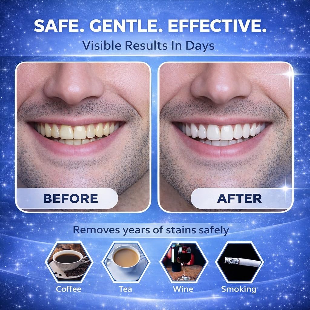 Thumbnail 4 de Professional Teeth Whitening Strips 21 Treatments by MrWhites: For Sensitive Teeth, 42 Strips + Mouth Opener