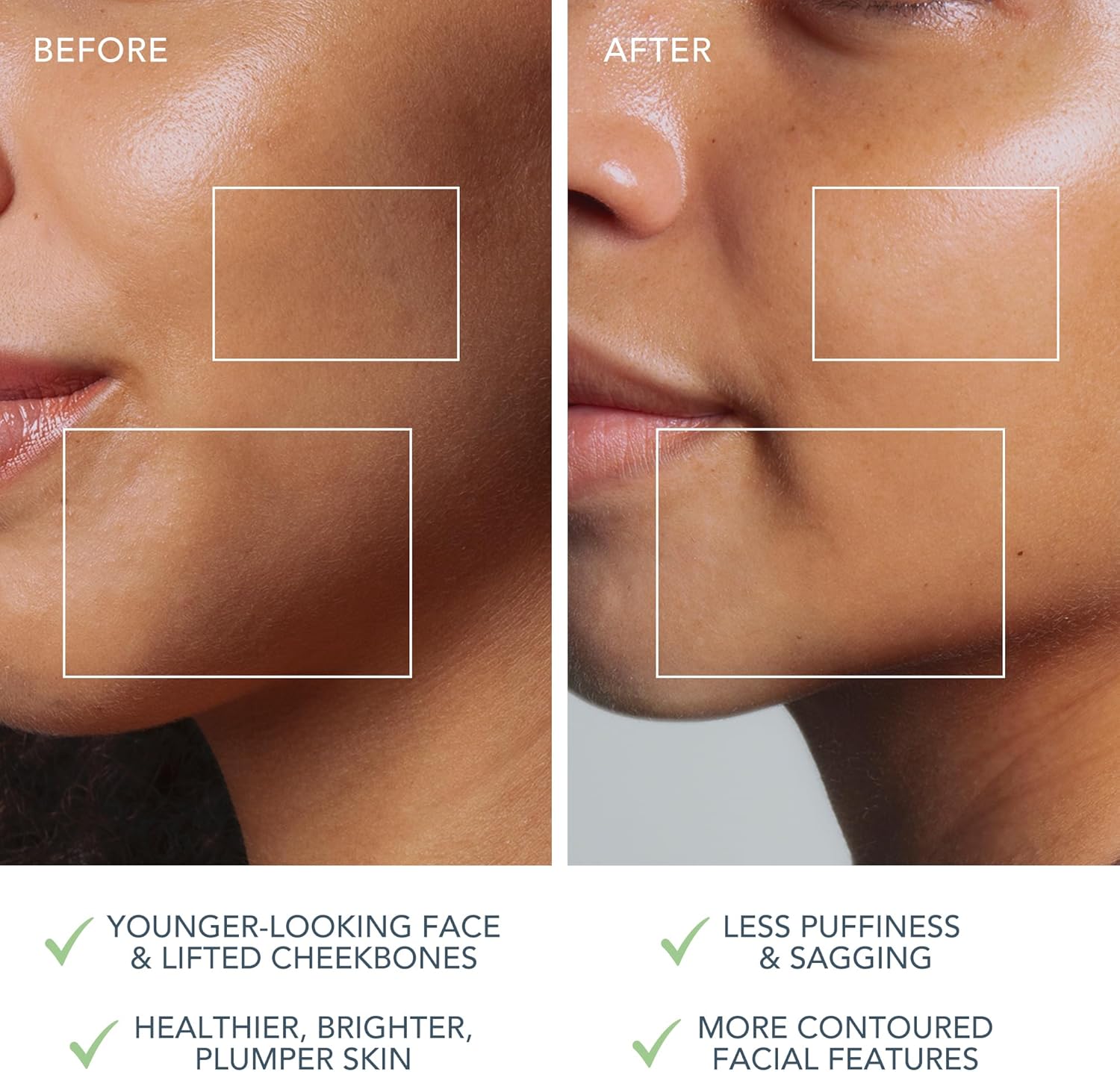 Thumbnail 4 de Foreo Bear 2 Go massaggiatore viso lifting a microcorrente (pistacchio) compatto da viaggio