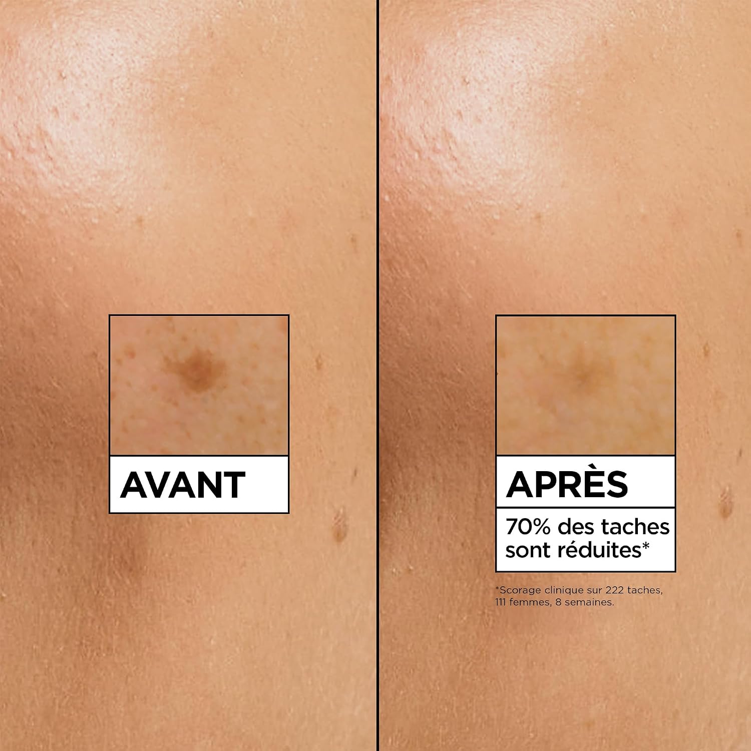 Detalle de GARNIER Skin Active Sérum Éclat anti-taches 30 ml