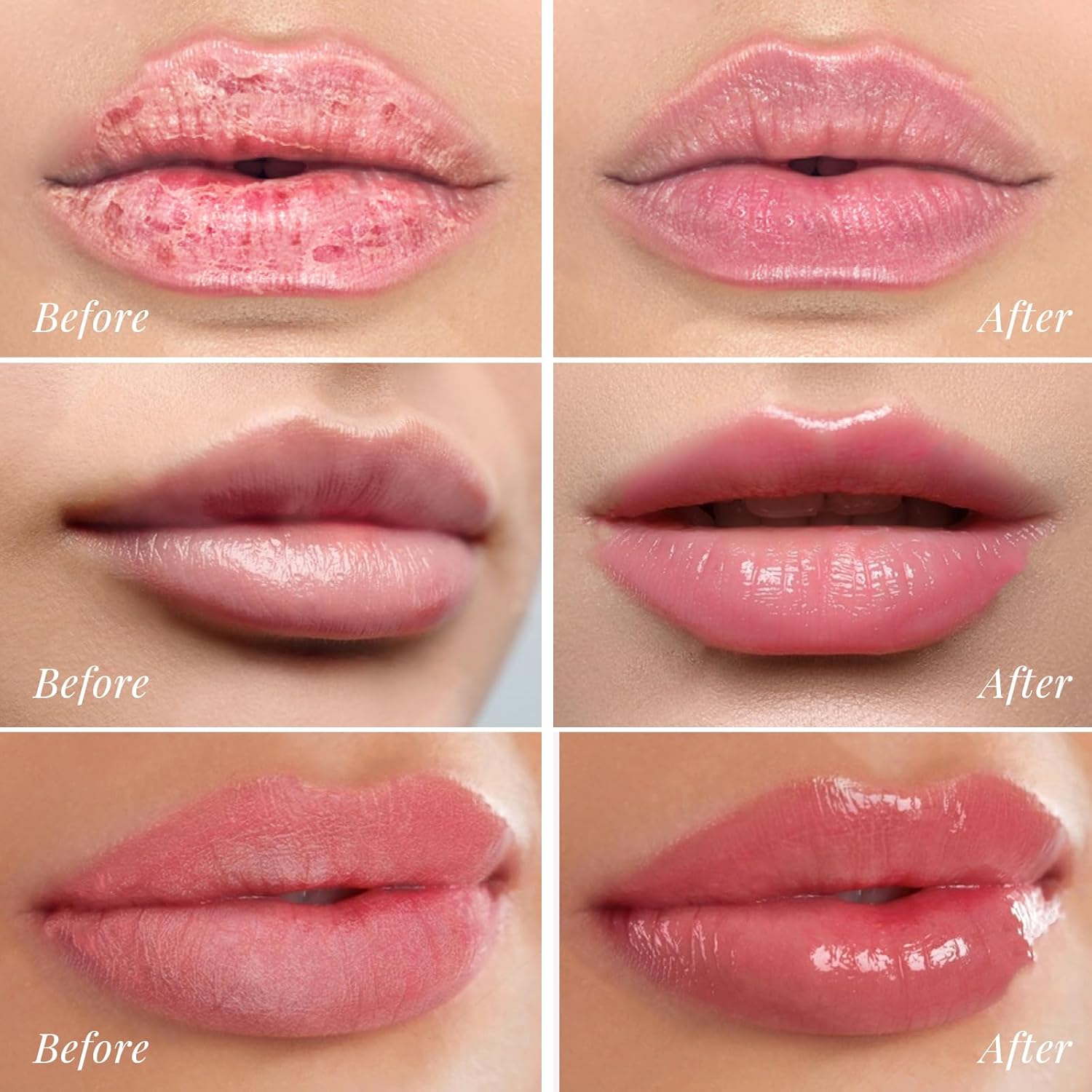 Detalle de ANRCOLLECT Lip Balm Set: kit di 4 maschere notturne per labbra idratate