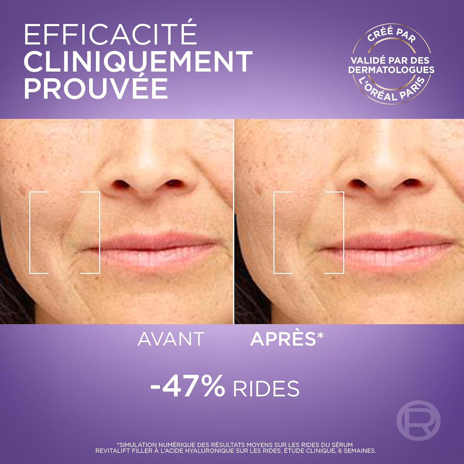 Detalle 2 de L’Oréal Paris Revitalift Filler Sérum Anti-Rides & Anti-Âge – 1,5% Acide Hyaluronique Pur, 30 ml