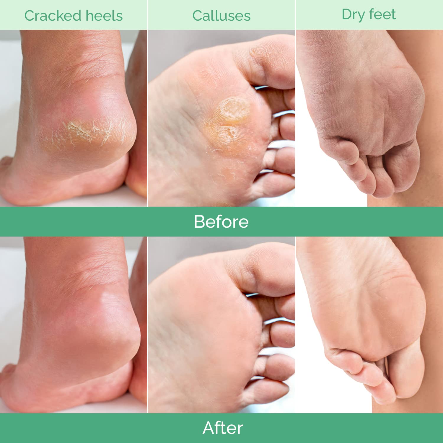 Detalle de Plantifique Foot Peeling Mask 2 Pack