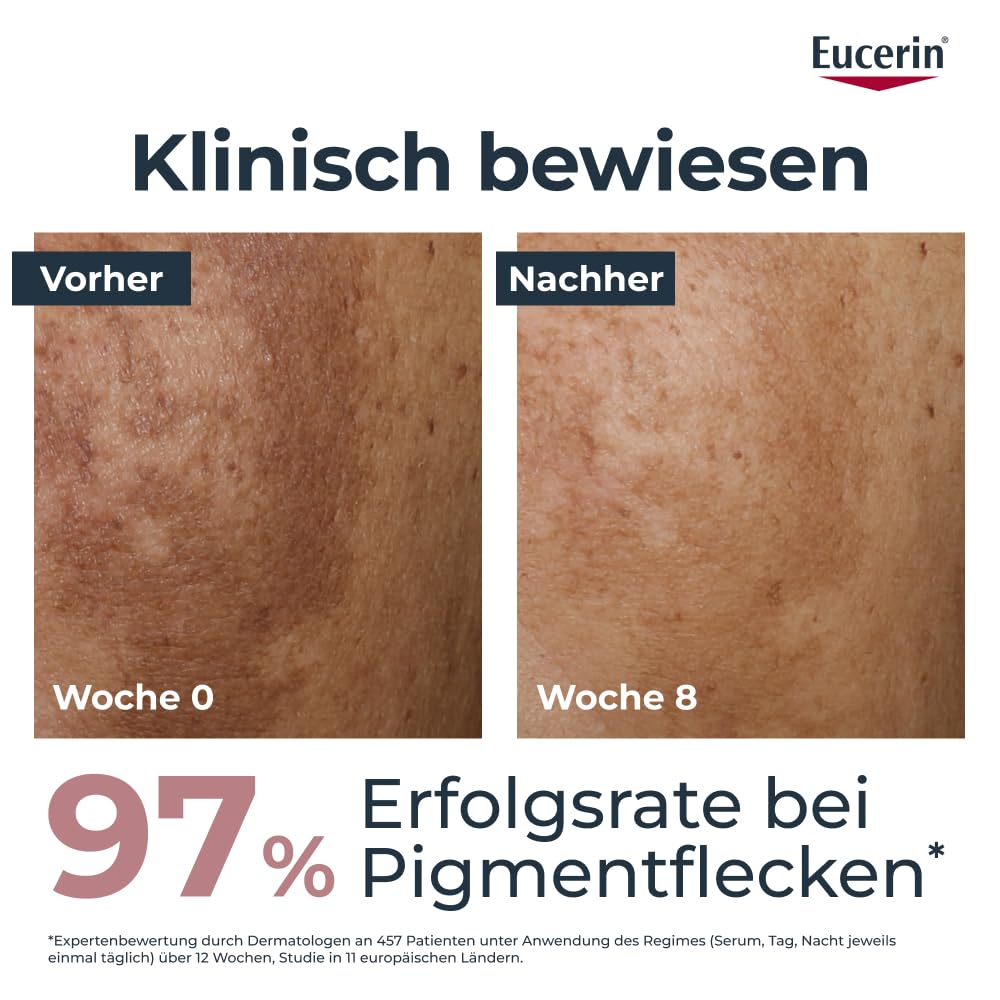 Thumbnail 2 de Eucerin Anti-Pigment Dual Serum (30 ml) mit Thiamidol & Hyaluronsäure