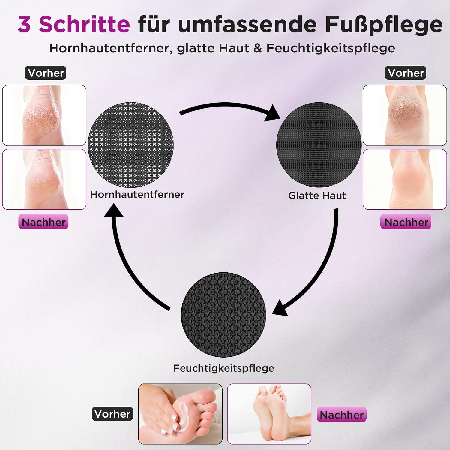 Thumbnail 2 de Elektrischer Hornhautentferner mit Öl-Funktion – Foot SPA mit Nano-Glas-Aufsatz, wiederaufladbar und ergonomisch aus Aluminium