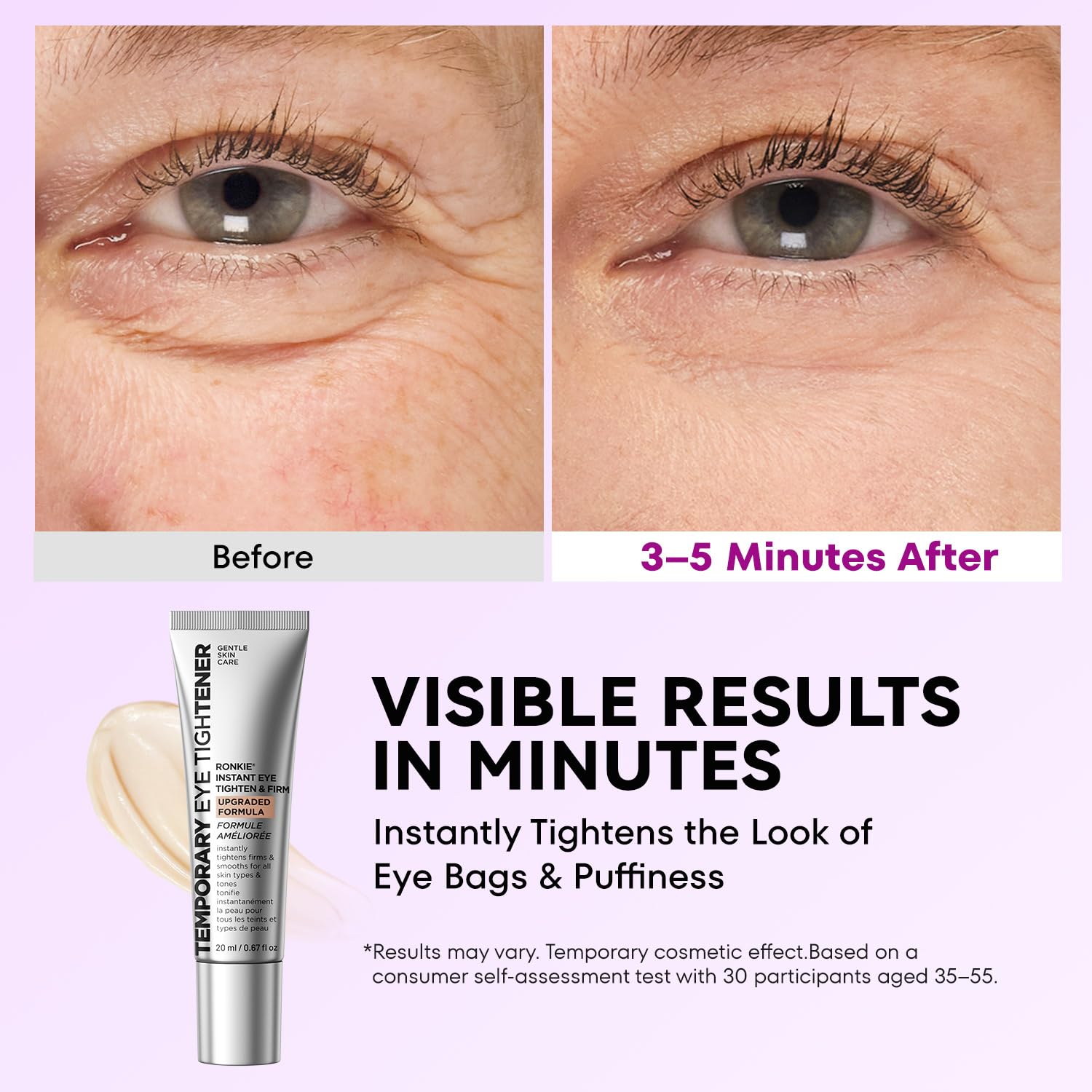 Detalle 2 de RONKIE Instant Firm Eye Tightener: Upgraded Formula for Women, 0.67 oz