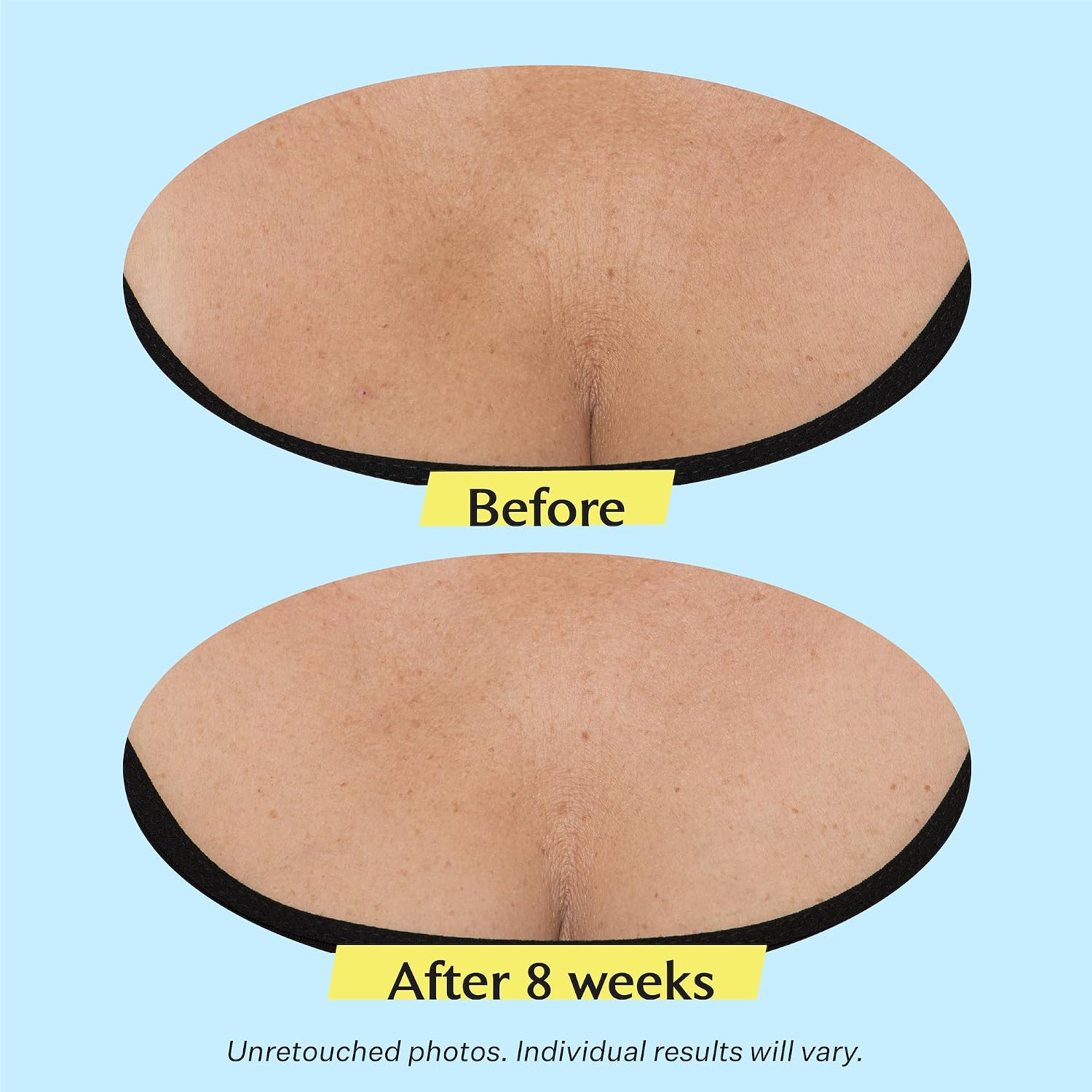 Detalle 1 de StriVectin neck cream tighten and lift