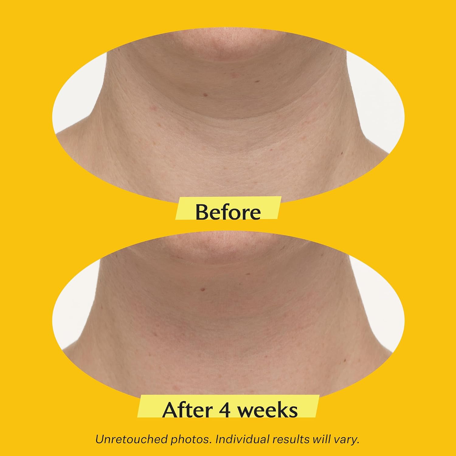 Detalle 2 de StriVectin neck cream tighten and lift