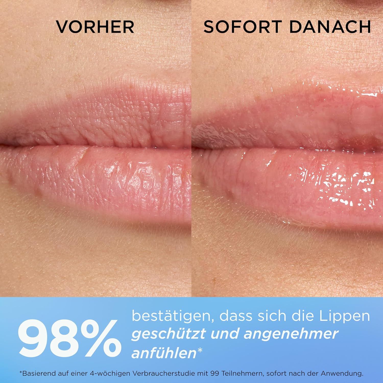 Thumbnail 6 de Elizabeth Arden Eight Hour Intensiver Reparatur-Lippenbalsam – 10 ml