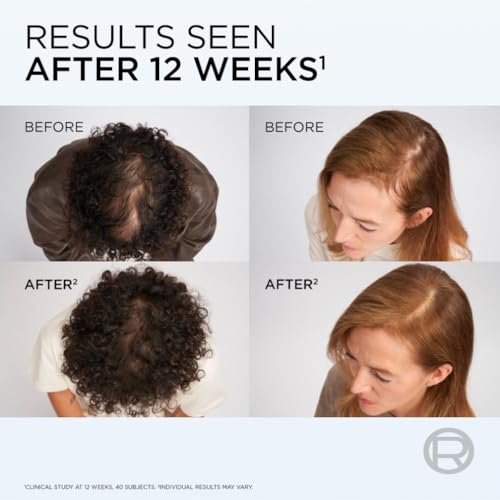 Thumbnail 4 de L'Oréal Paris Elvive Growth Booster Hair Growth Serum – 102ml