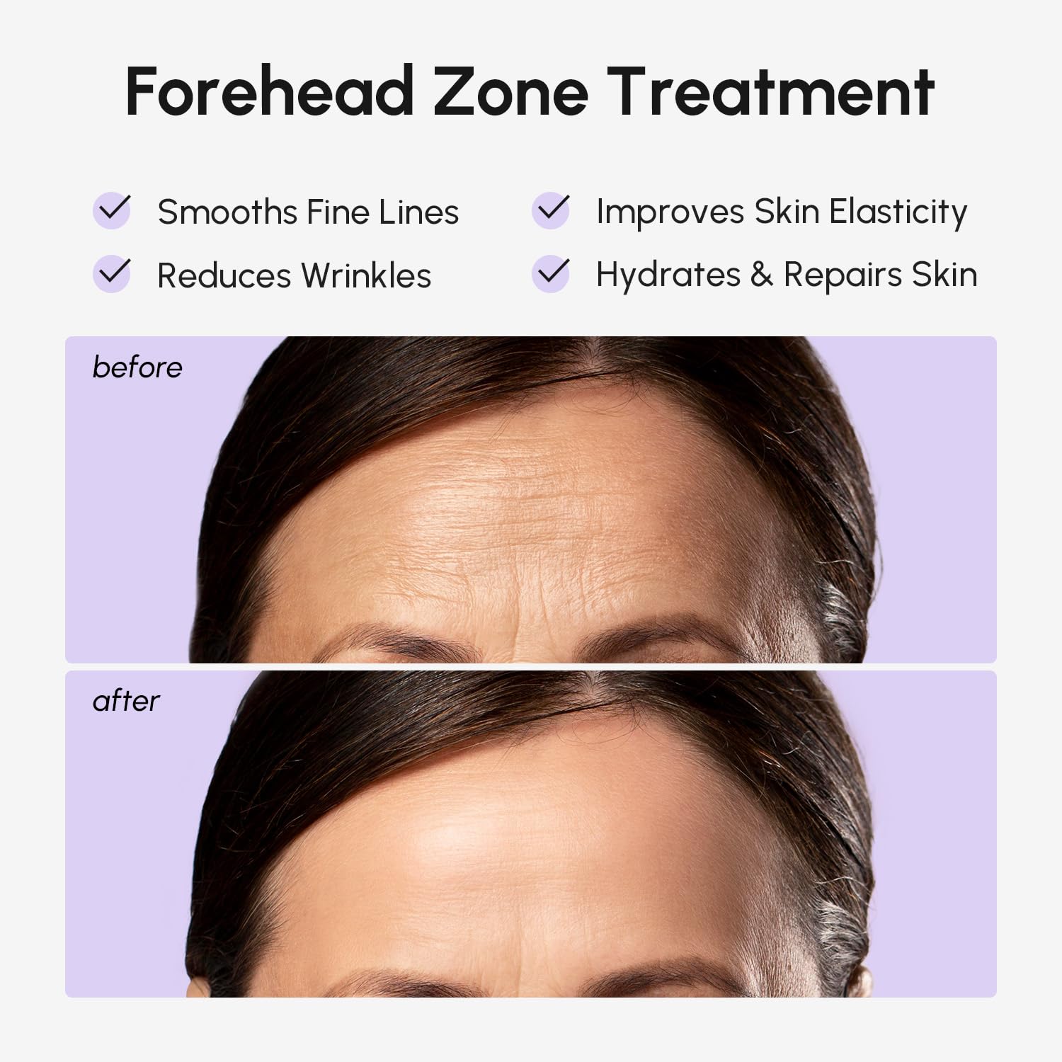 Thumbnail 2 de MAREE Forehead Wrinkle Patches for Deep Lines 🎭