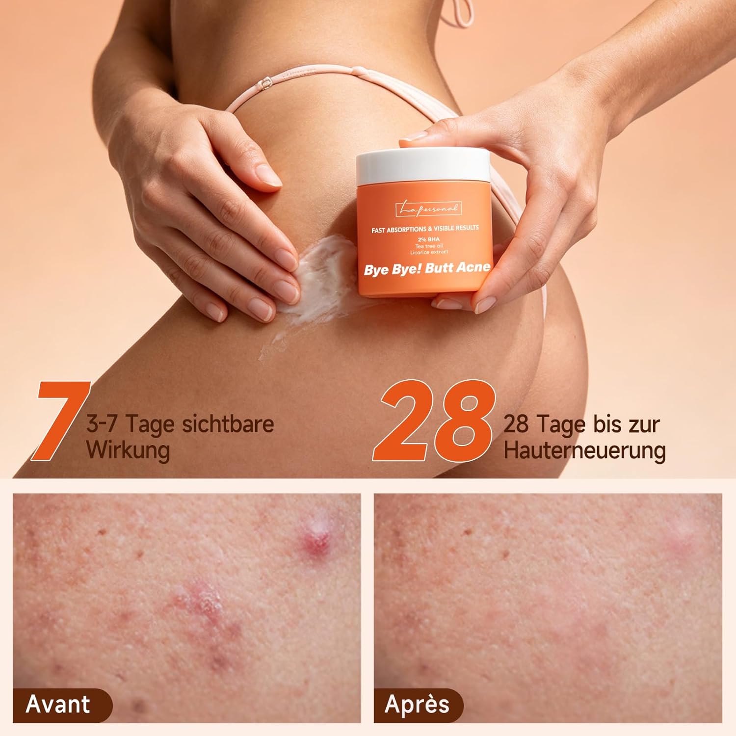 Thumbnail 5 de LA.PERSONAL Body Acne Cream 160 ml