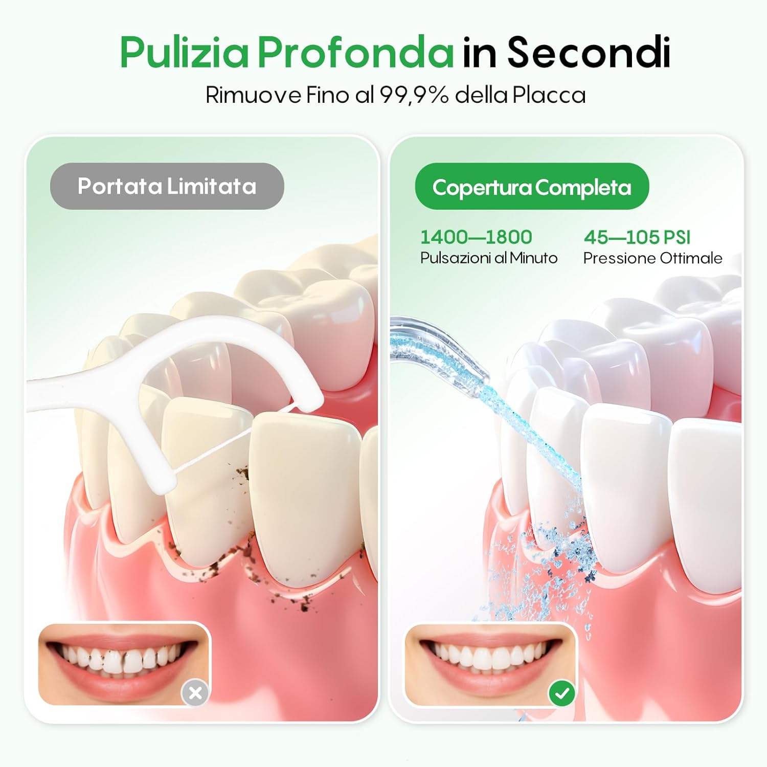 Thumbnail 1 de FRESKO Idropulsore Dentale 300ML
