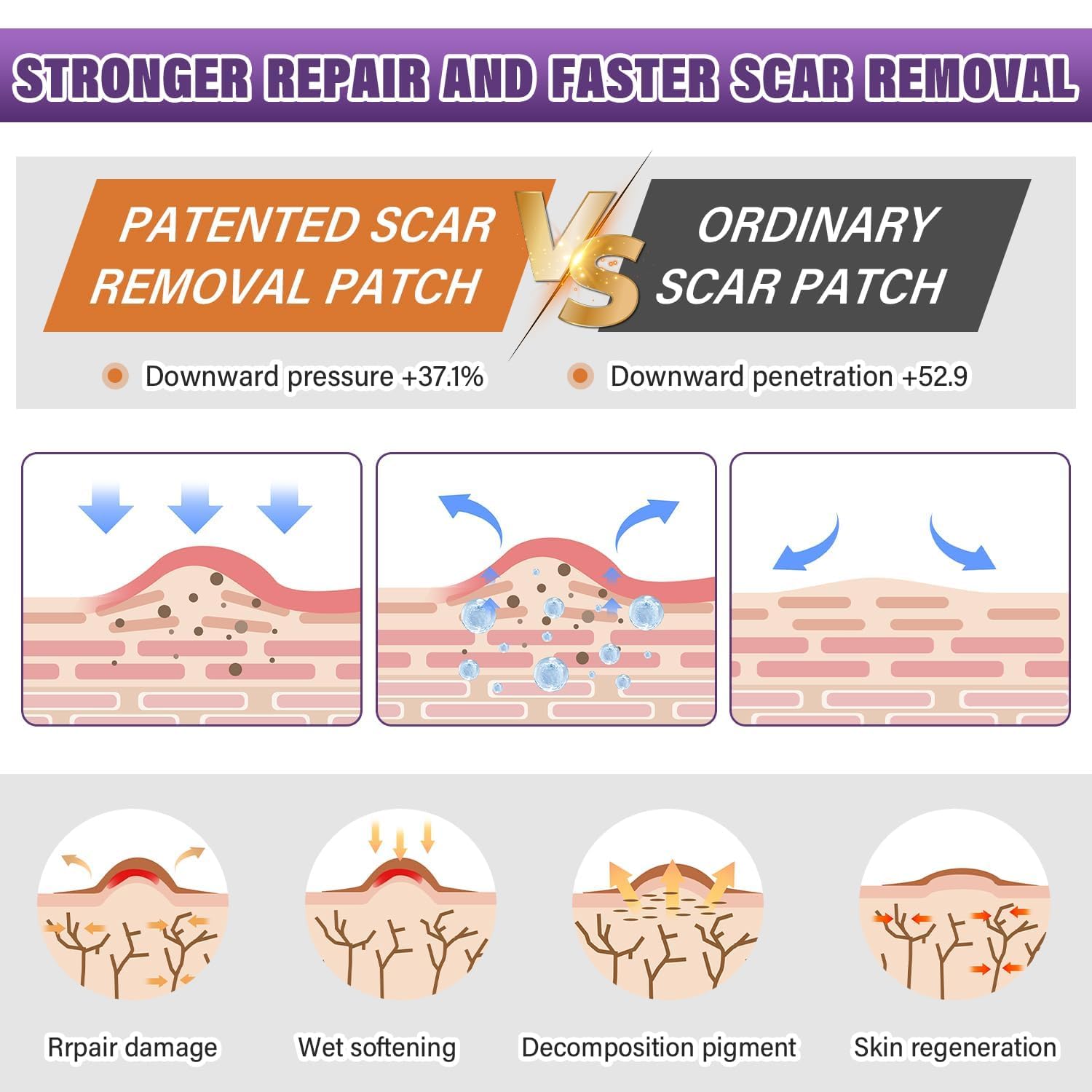Thumbnail 2 de Silicone Scar Sheets 1.6" x 157" Roll
