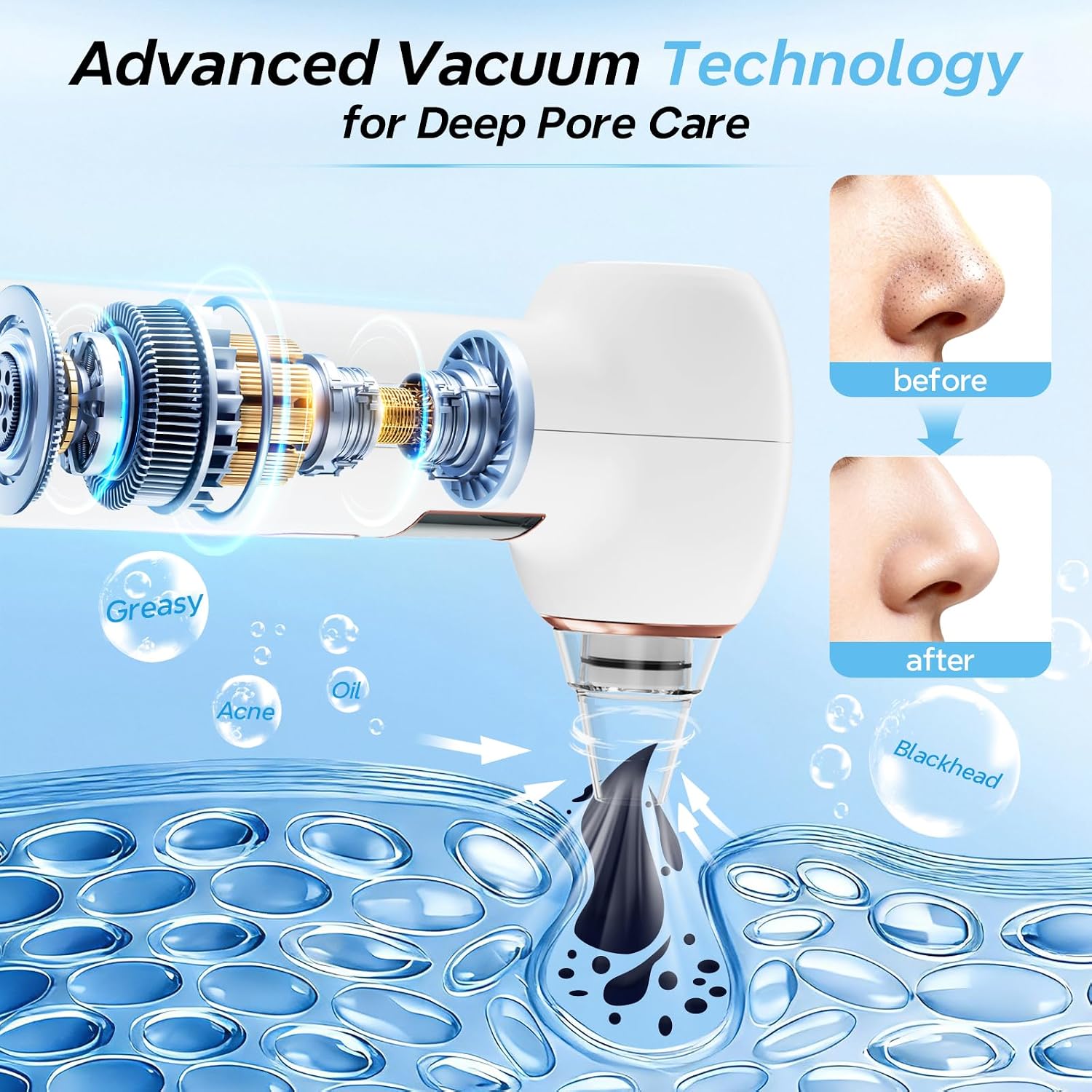 Detalle 2 de Mylzdobs Blackhead Remover Vacuum with 3 Suction Levels and 5 Probes – White