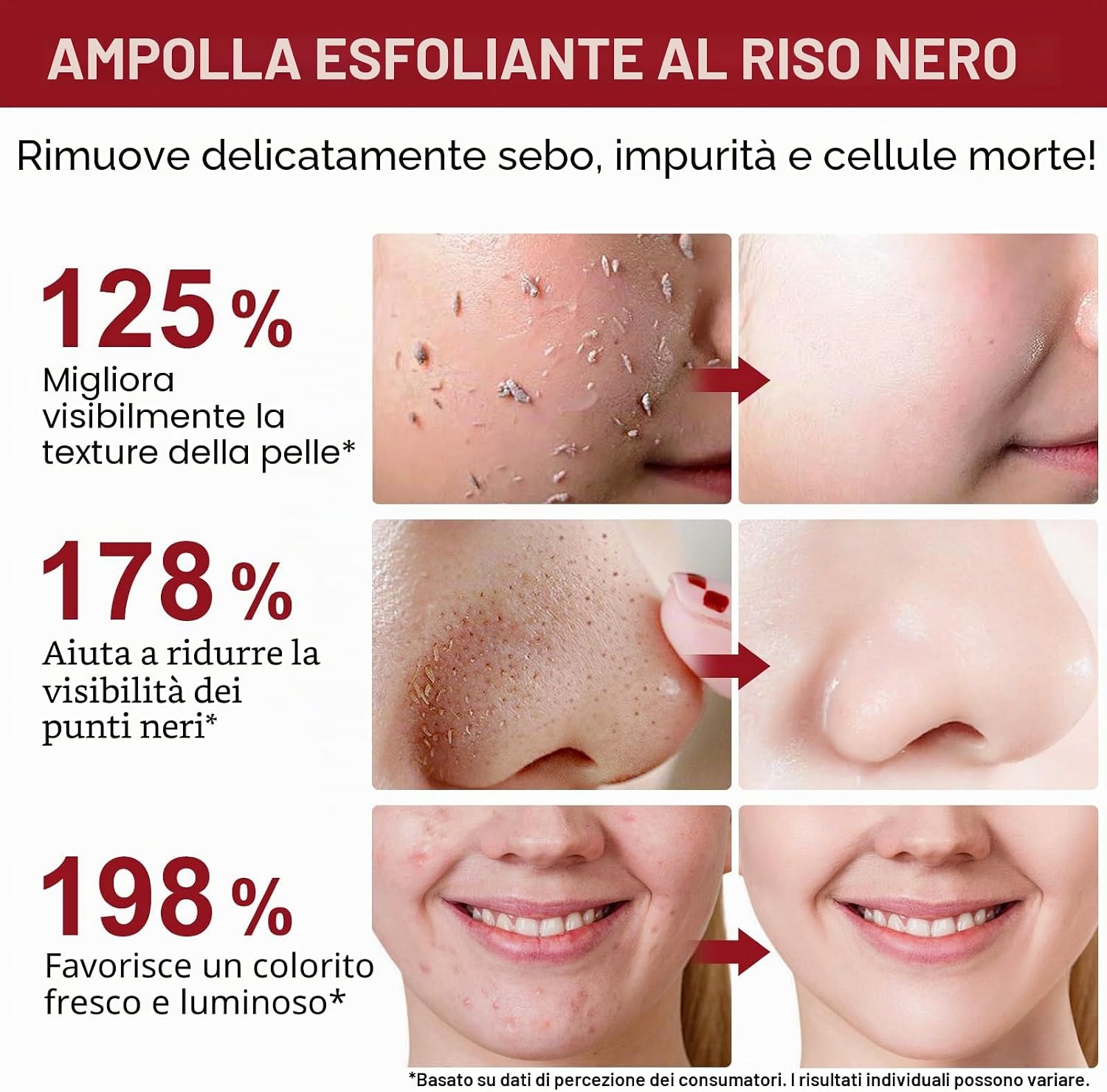 Thumbnail 6 de Siero Esfoliante al Riso Skincare + Peeling Viso Riso Nero 100 ml cadauno – doppia azione levigante e illuminante
