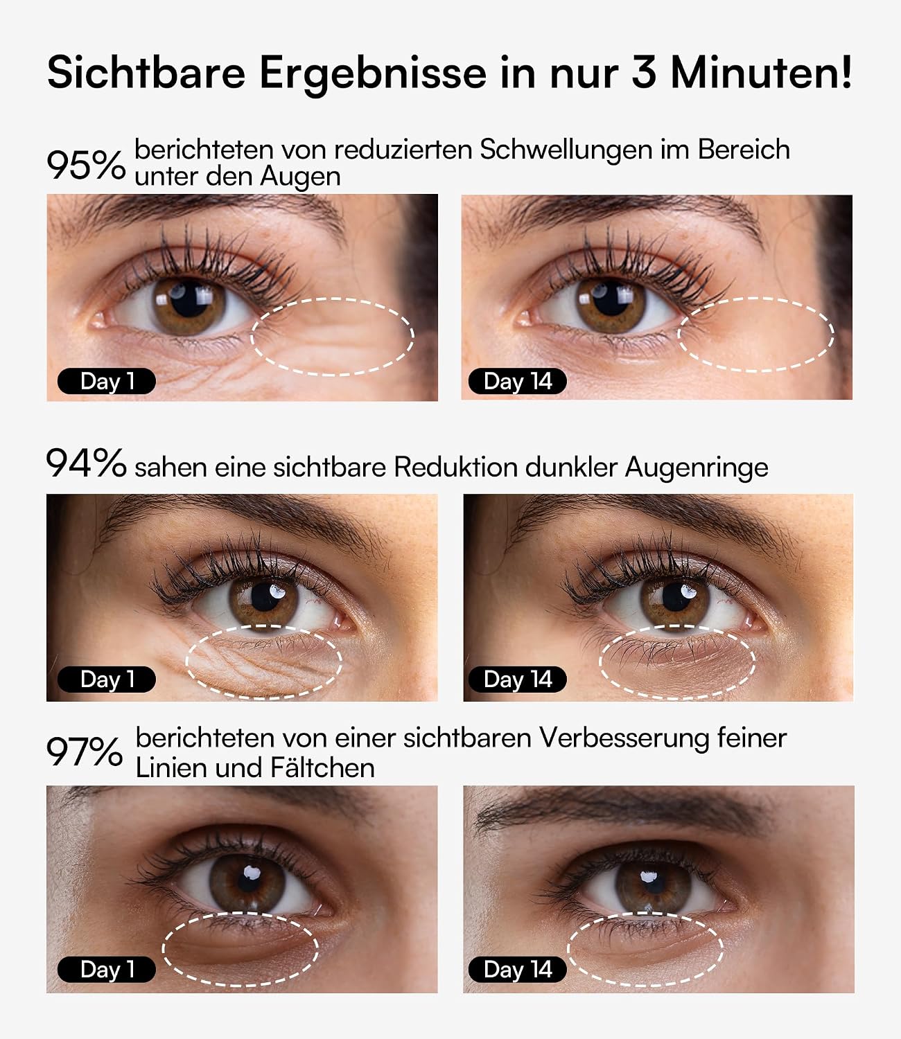 Detalle 2 de INIA Augenmassagegerät gegen Augenringe & Tränensäcke – EMS, Rotlicht & Wärme für Hautstraffung (3 Modi, tragbar)