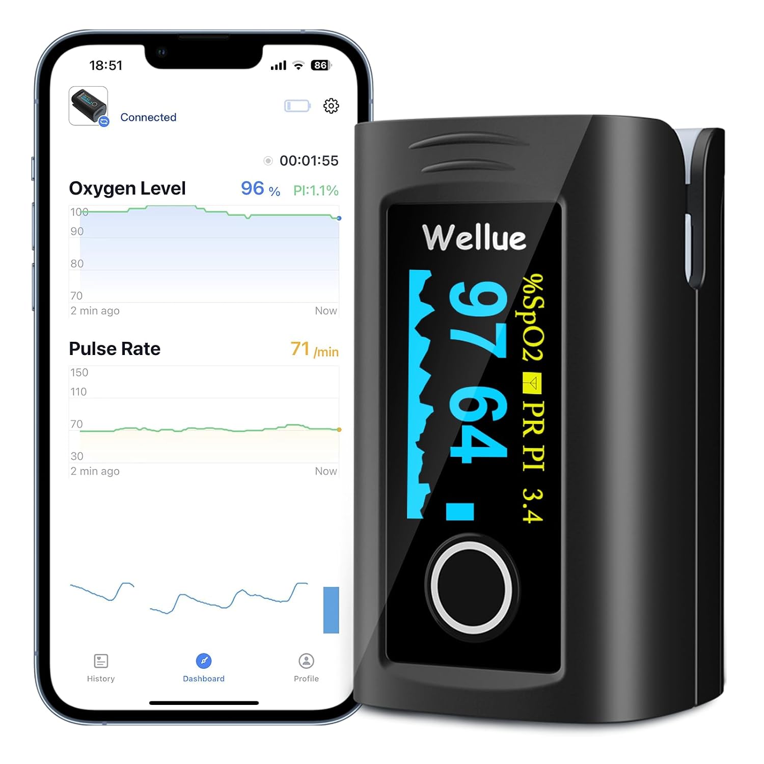 Detalle de Wellue Fingertip Pulse Oximeter