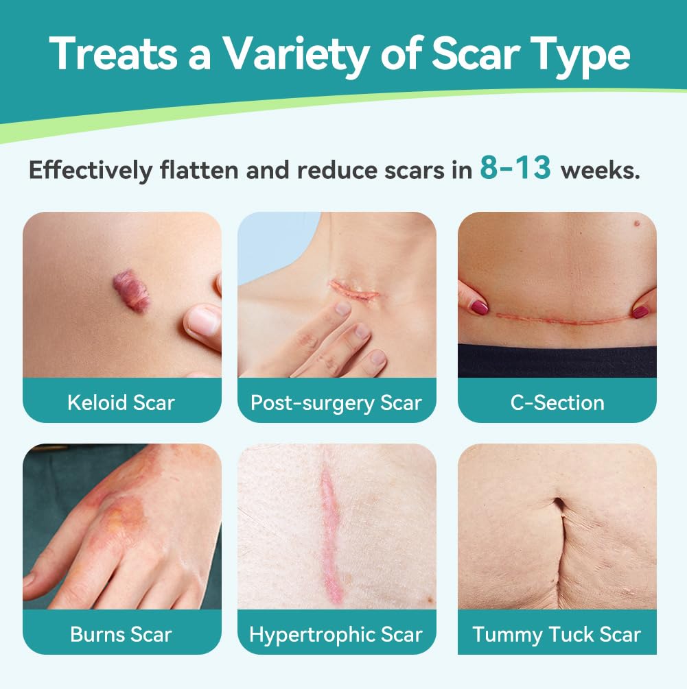 Thumbnail 2 de Dimora Silicone Scar Sheets 1.6 in roll