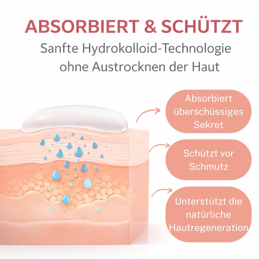 Detalle de VELVET YOUTH Unsichtbare Pickel-Patches „Hydrokolloid“ – 96 Hydrokolloid Pflaster in 3 Größen