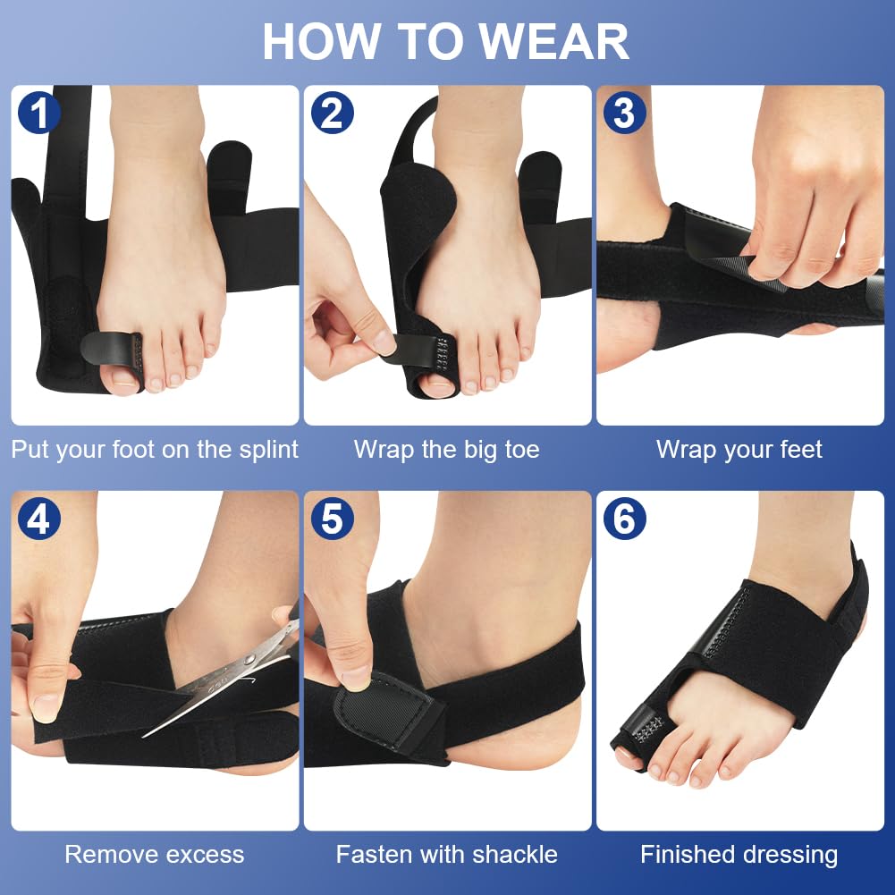 Detalle 2 de ACWOO 4062627 hallux-valgusset met verstelbare spalken en gelteenstrekkers