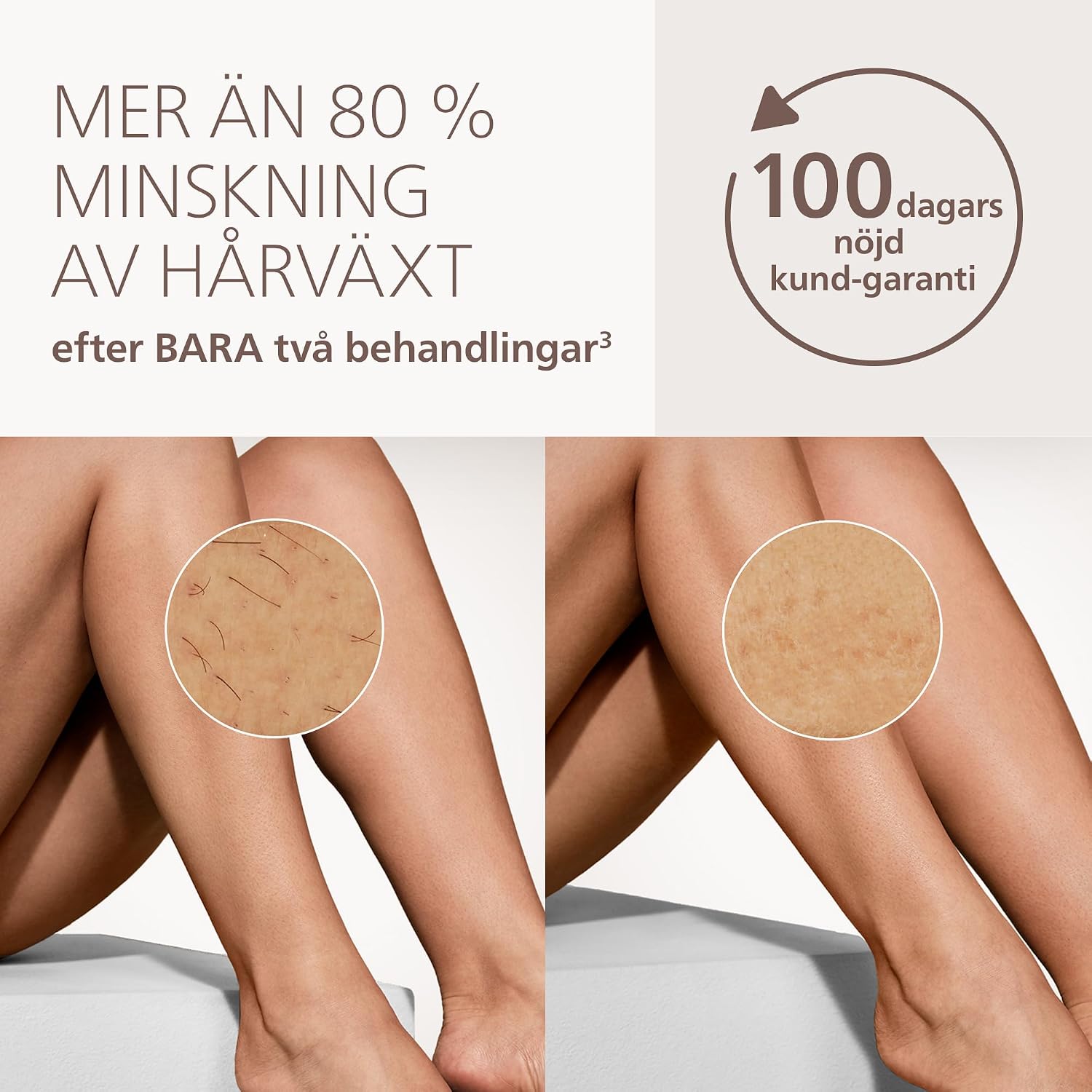 Detalle de Philips Lumea 9000 BRI938/00 IPL-hårborttagare med tre tillbehör och SmartSkin