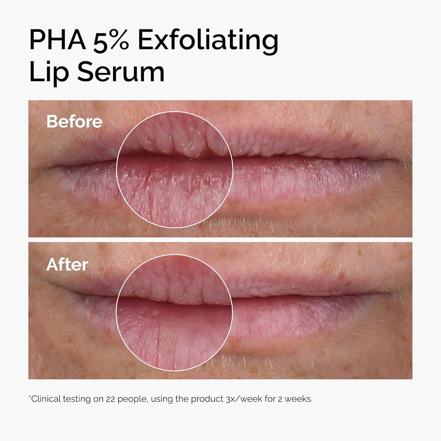 Thumbnail 2 de The Ordinary PHA 5% Exfoliating Lip Serum: Overnight Hydration and Gentle Lip Exfoliation (15ml)