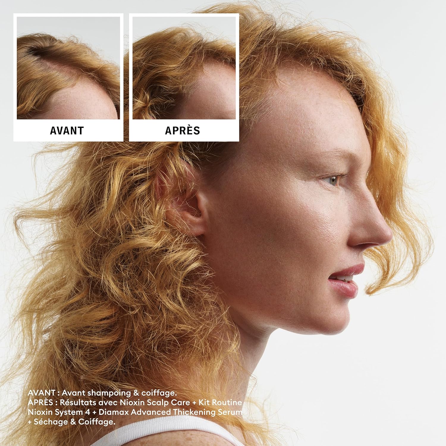 Thumbnail 4 de NIOXIN System 4 pour Cheveux Colorés, Secs et Abîmés – Kit Complet