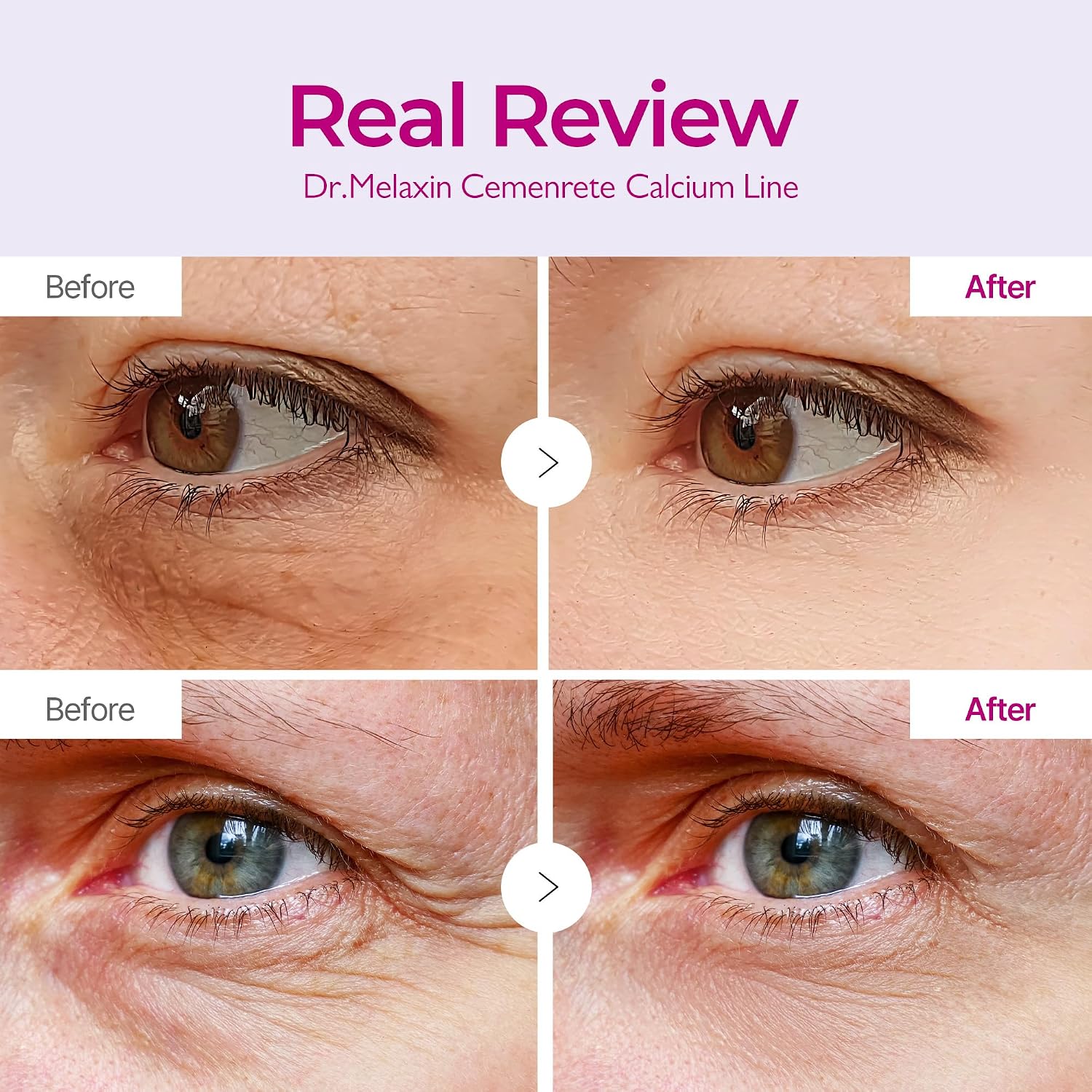 Detalle de Dr.Melaxin Calcium Volume Under-Eye Patches, Hydrogel, 60 Count
