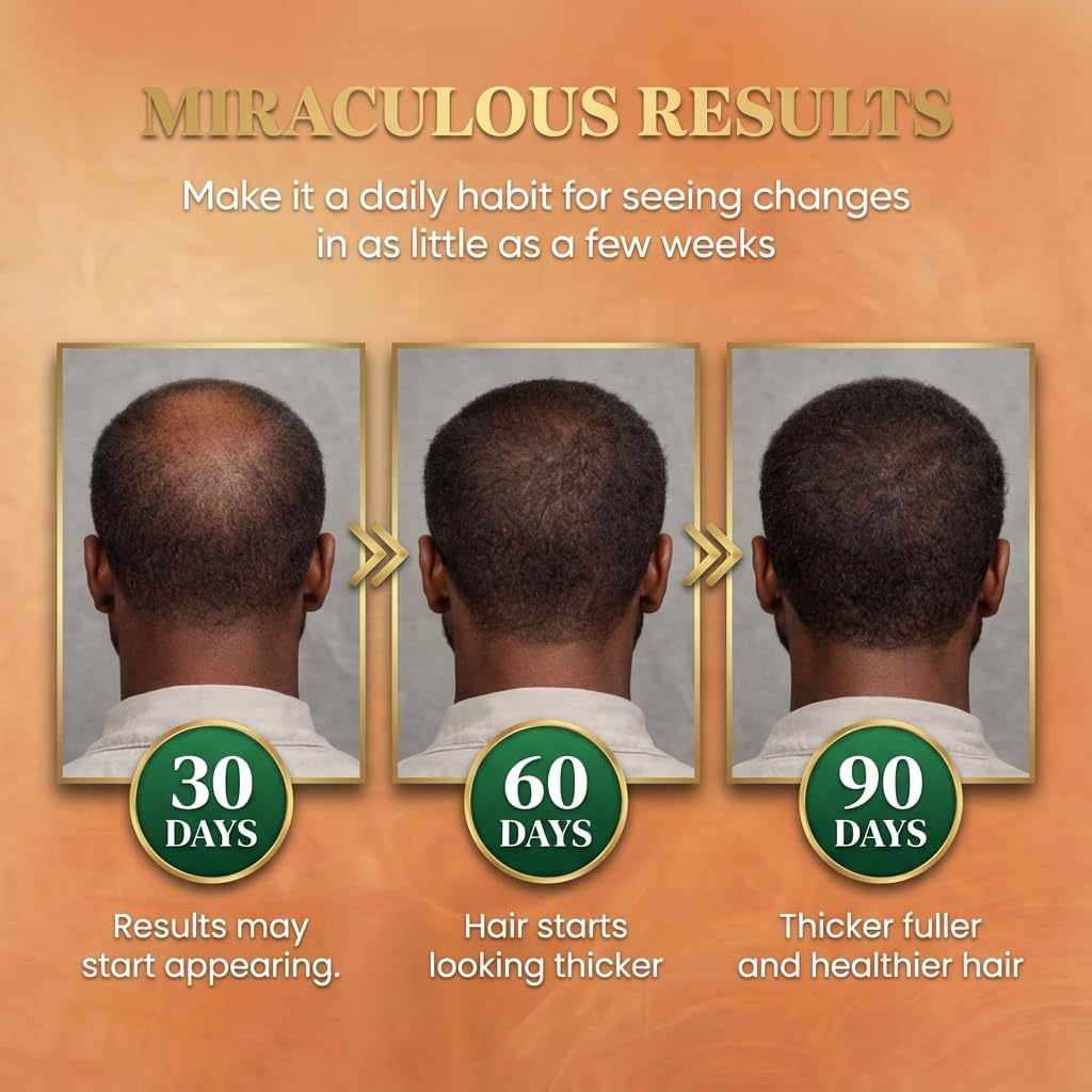 Detalle de Batana Oil for Hair Growth by Dr Sebi – 100% Raw Organic Batana Hair Mask (4.06 fl oz)