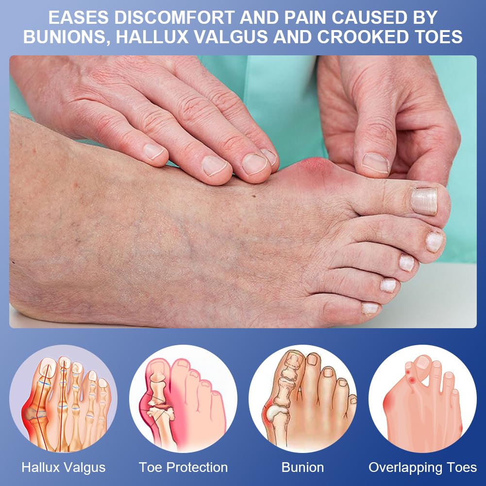 Detalle 2 de ACWOO 4062627 hallux-valgusset met verstelbare spalken en gelteenstrekkers